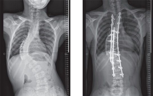 Patient X-ray