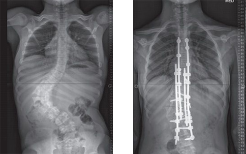 Patient X-ray