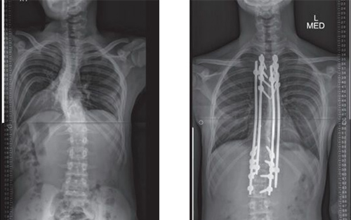 Patient X-ray
